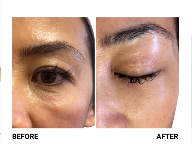 nucleoskin-topic-ba-1