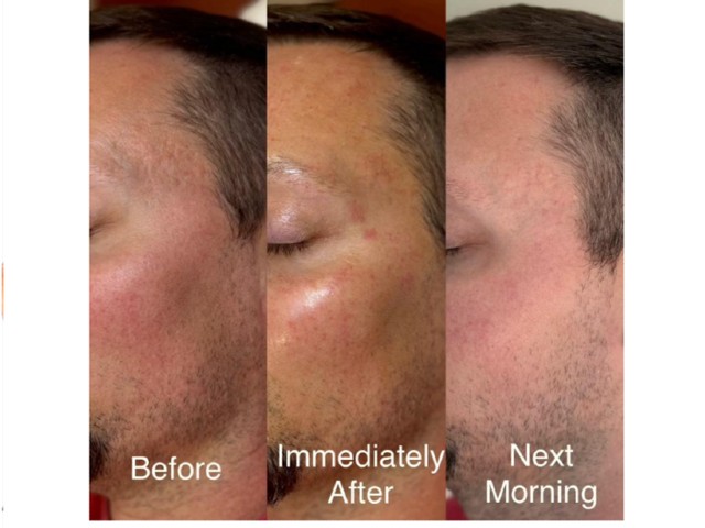 nucleoskin-topic-ba-2