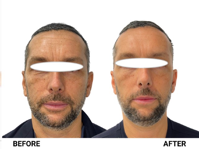nucleoskin-topic-ba-3
