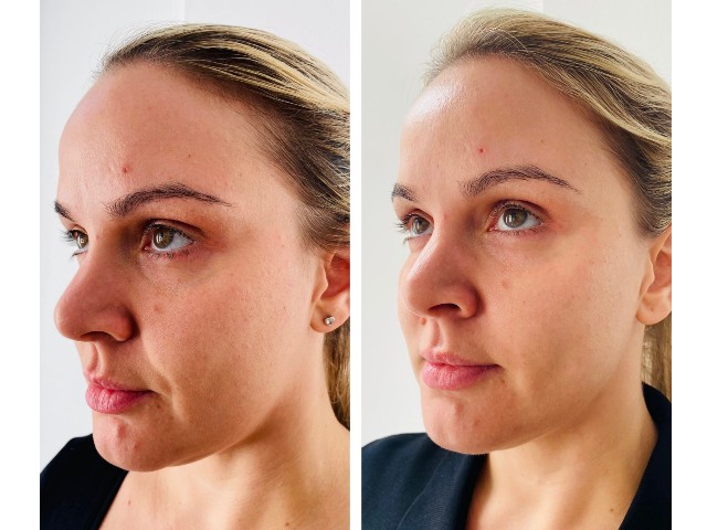 nucleoskin-topic-ba-5